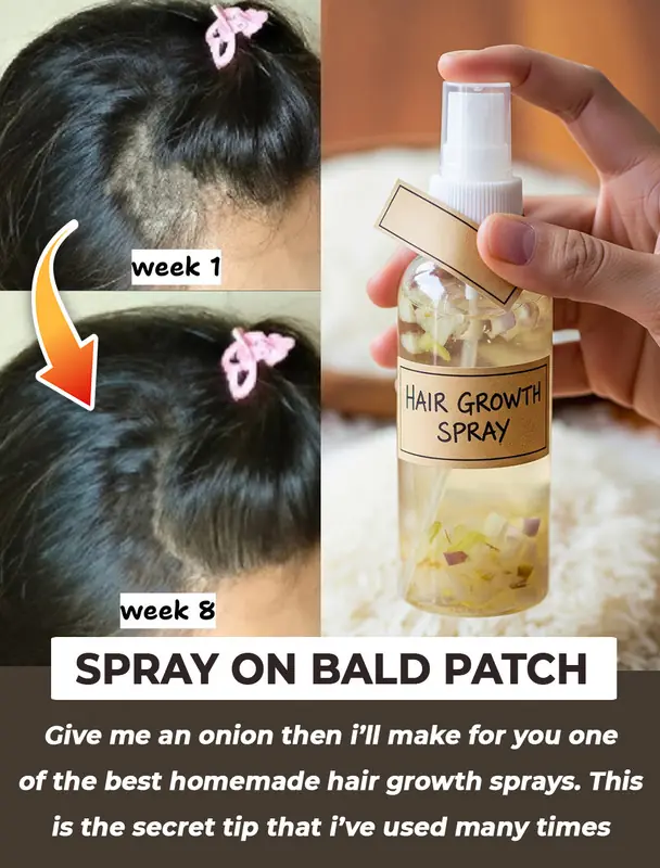 DIY Onion Rice Hair Mask To Boost Hair Growth