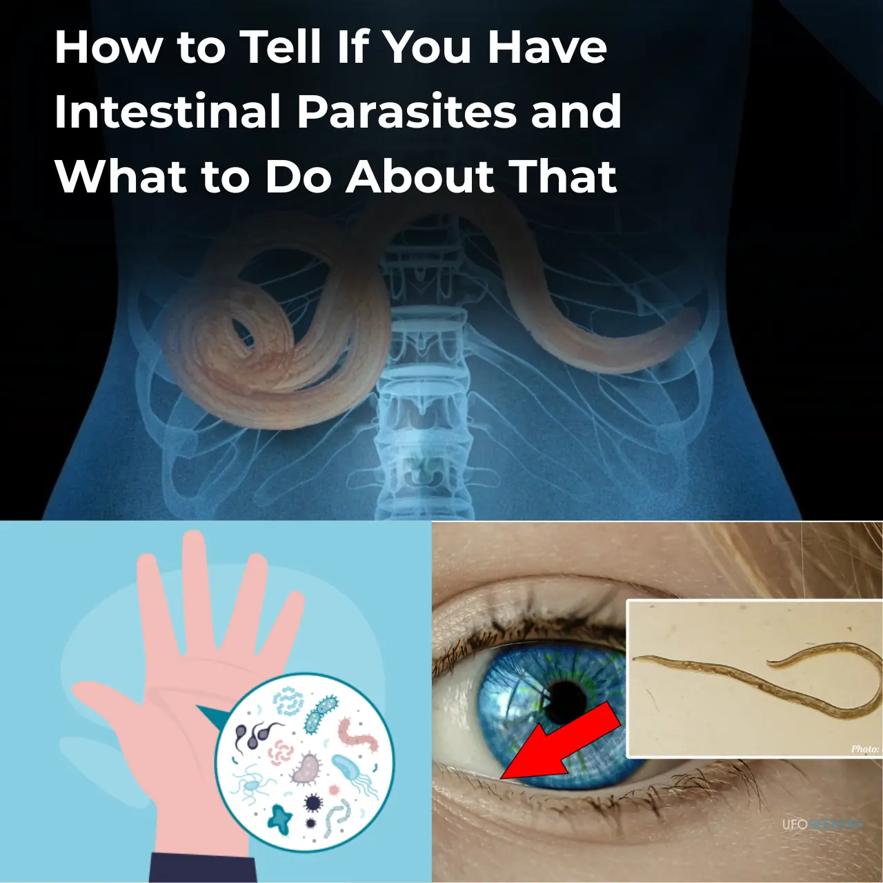 How to Tell If You Have Intestinal Parasites and What to Do About That