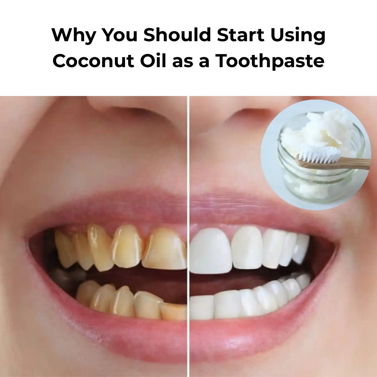 Why You Should Start Using Coconut Oil as a Toothpaste
