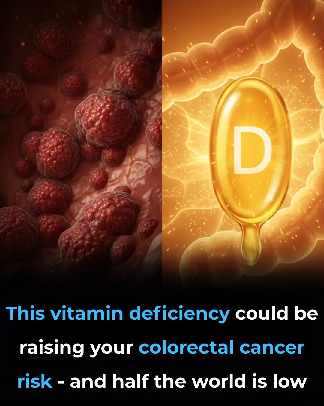 This vitamin deficiency could be raising your colorectal cancer risk — and half the world is low