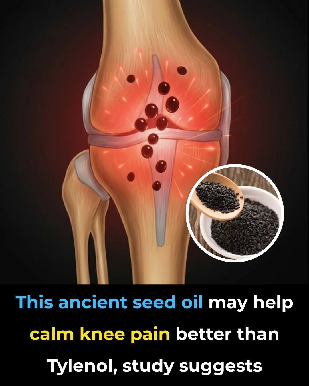 This ancient seed oil may help calm knee pain better than Tylenol, study suggests