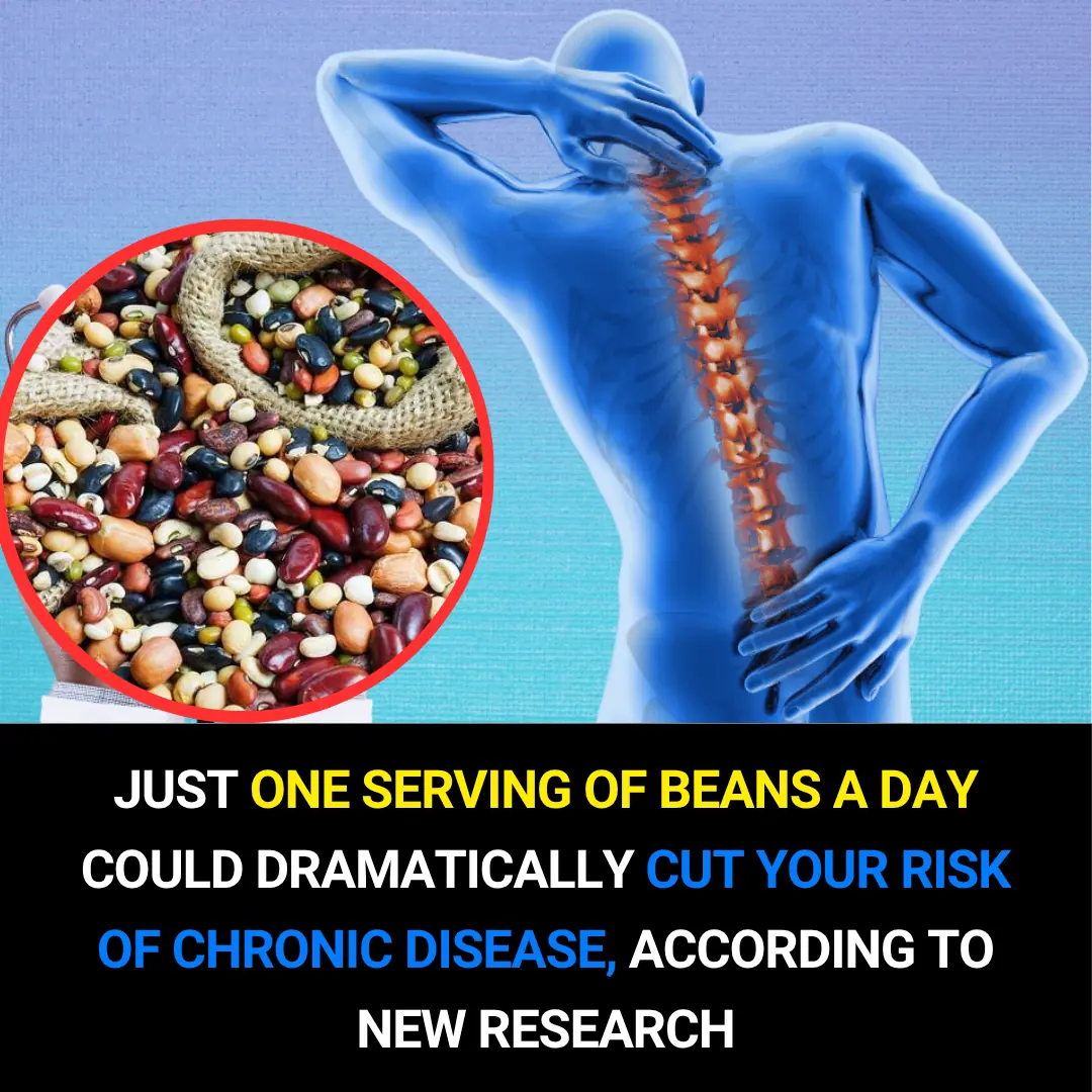 Eating Beans Daily Slashes Your Risk of Heart Disease and Diabetes, Study Finds