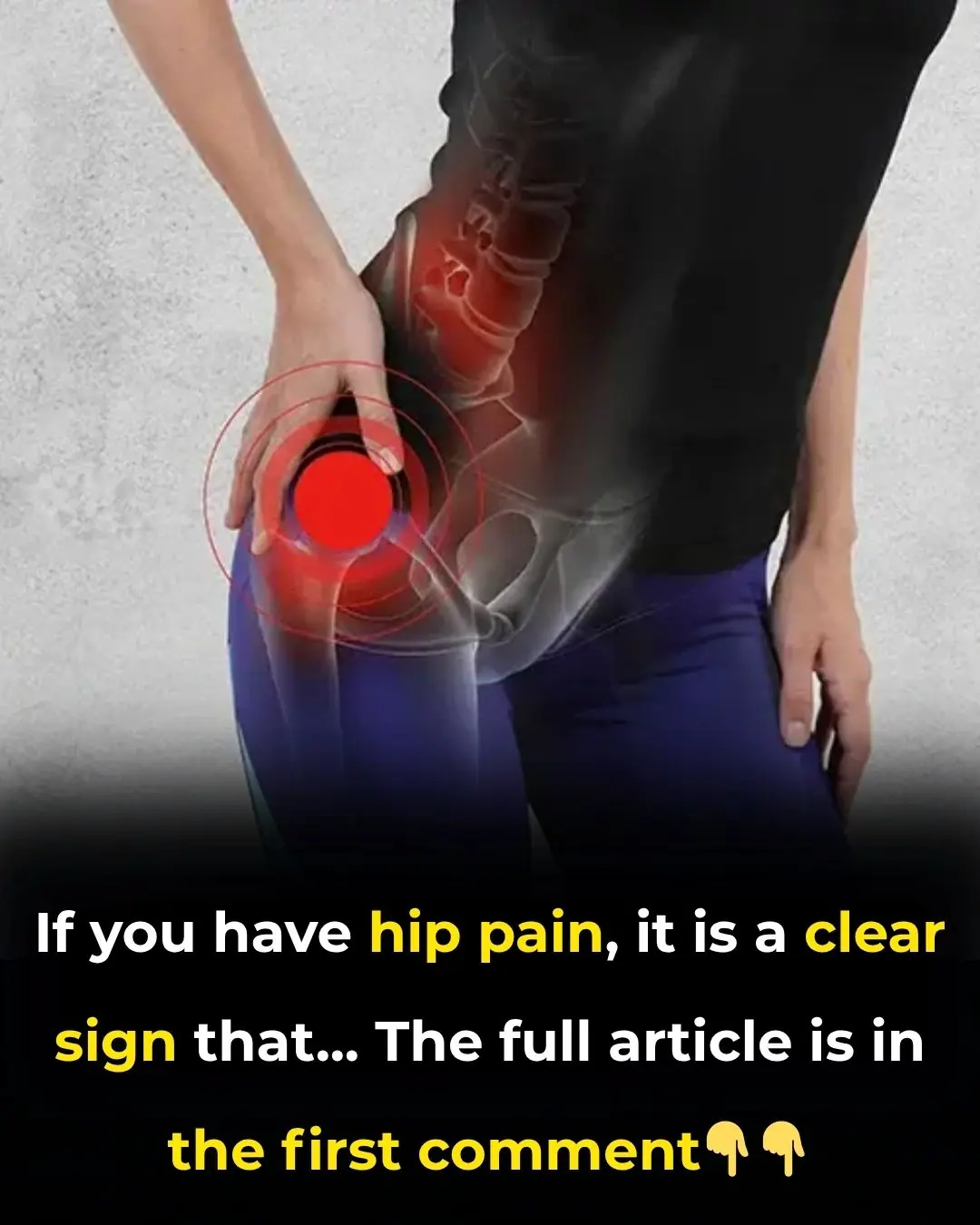 🦴 Hip Pain: What Does It Mean? Common Causes & When to Seek Help