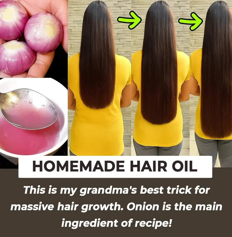 How to Make Onion Hair Oil for Faster Hair Growth and to Stop Hair Fall