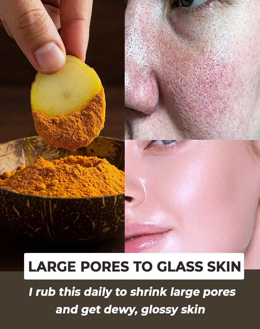 Potato Treatment For Dark Spots & Large Pores