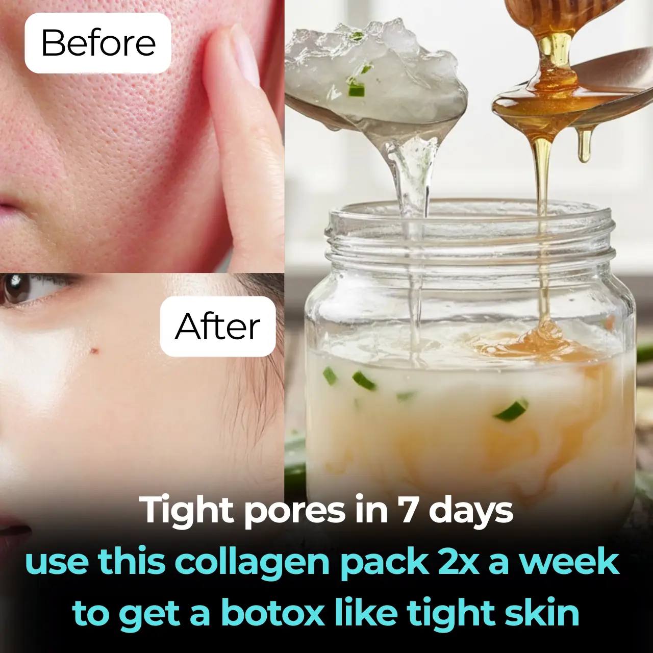 Get Rid Of Large Pores In 4 Steps, Naturally!