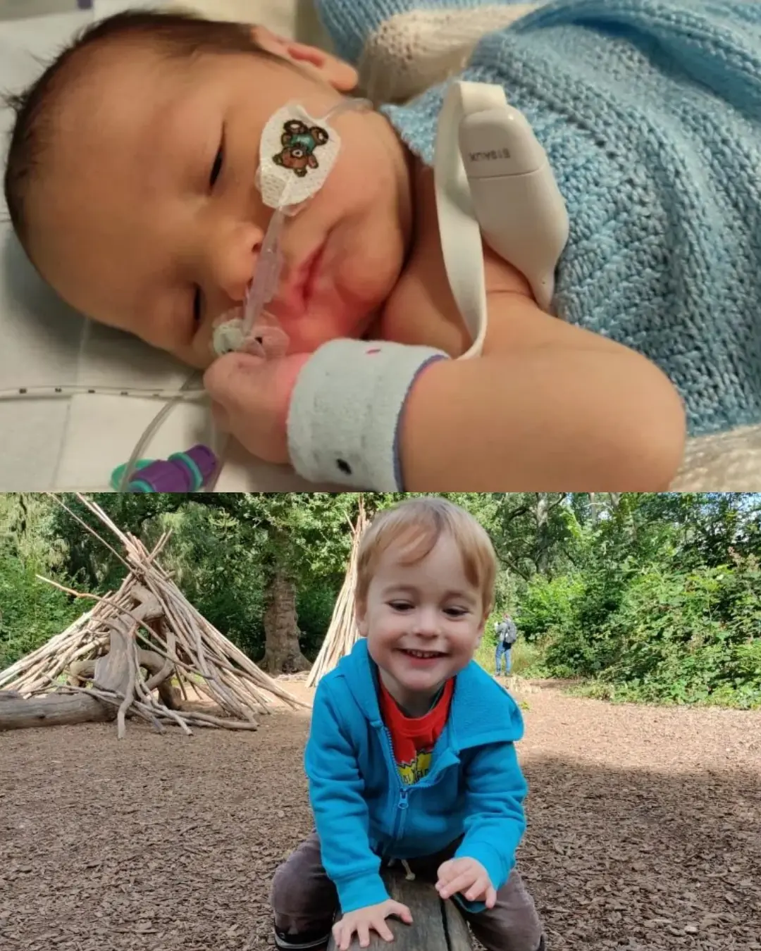 A Tiny Noise, a Lifesaving Alert: Oscar’s Journey Through TAPVC