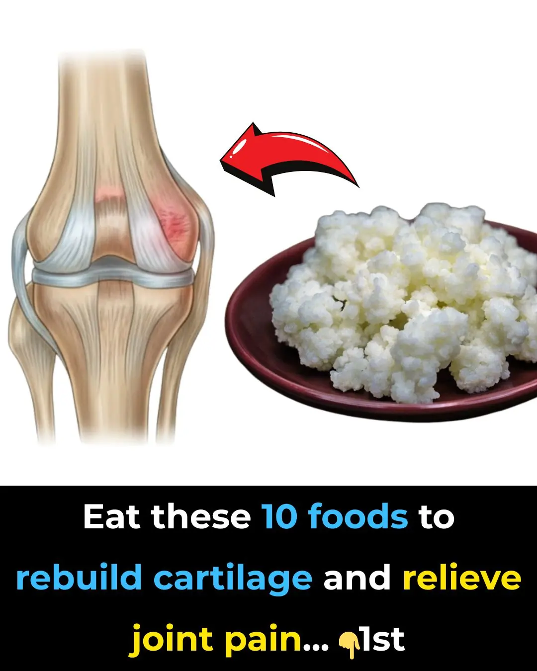 Top 10 Foods to Heal Knee Pain and Boost Cartilage