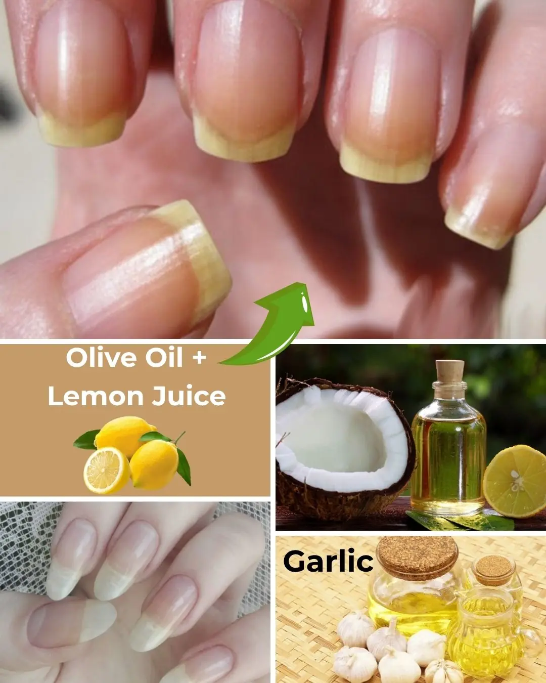 🌿 Natural Remedies to Strengthen Your Nails