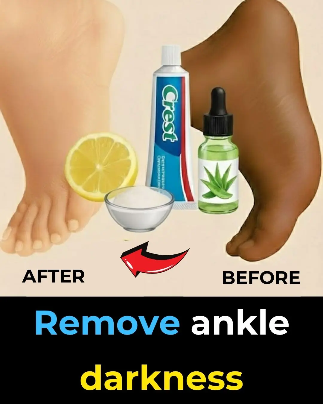 🦶 5 Natural Remedies for Cracked Heels