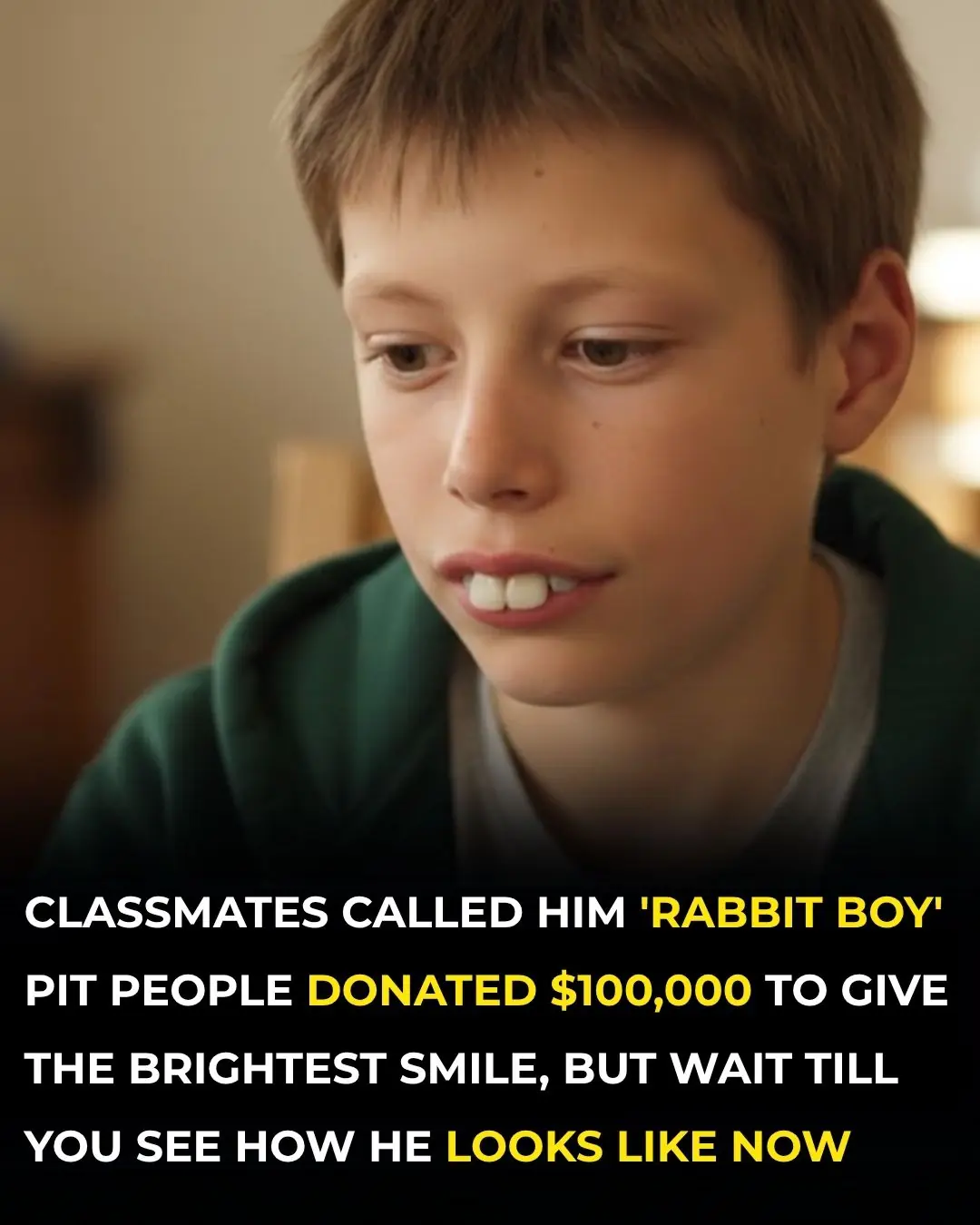 His Classmates Called Him “Rabbit Boy” – But Wait Till You See Him Now
