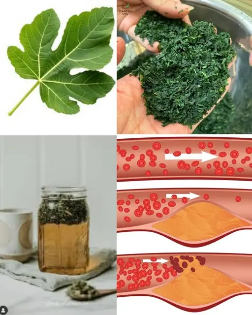 The Hidden Healing of Fig Leaves: Natural Support for Diabetes, Digestion, and More
