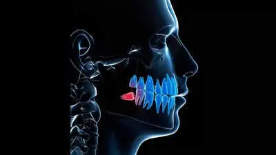 Humans are still evolving, and we’re losing our teeth