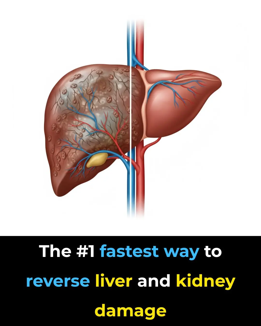 The #1 fastest way to reverse liver and kidney damage
