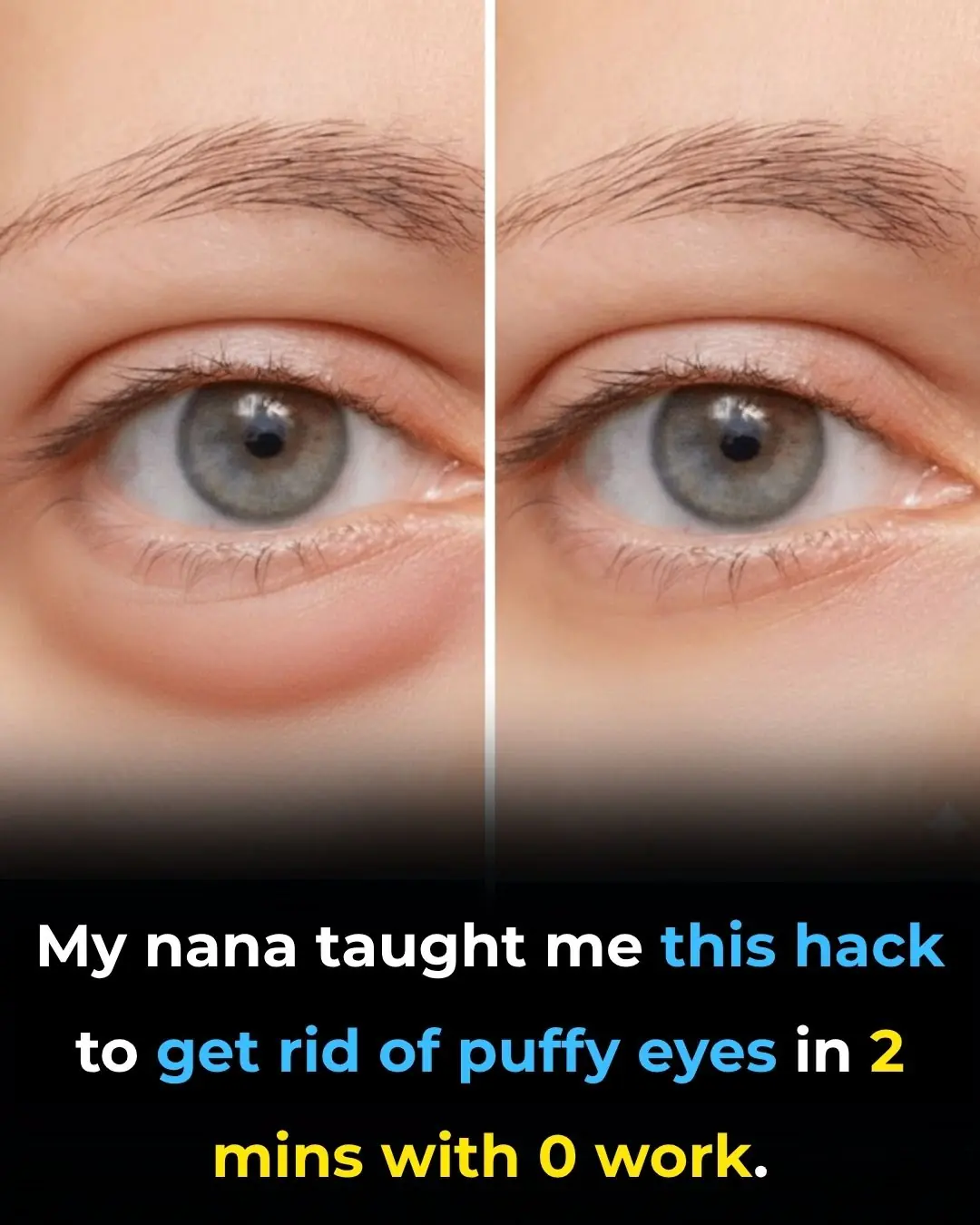 My Nana’s 2-Minute Trick to Get Rid of Puffy Eyes (No Work Needed!)