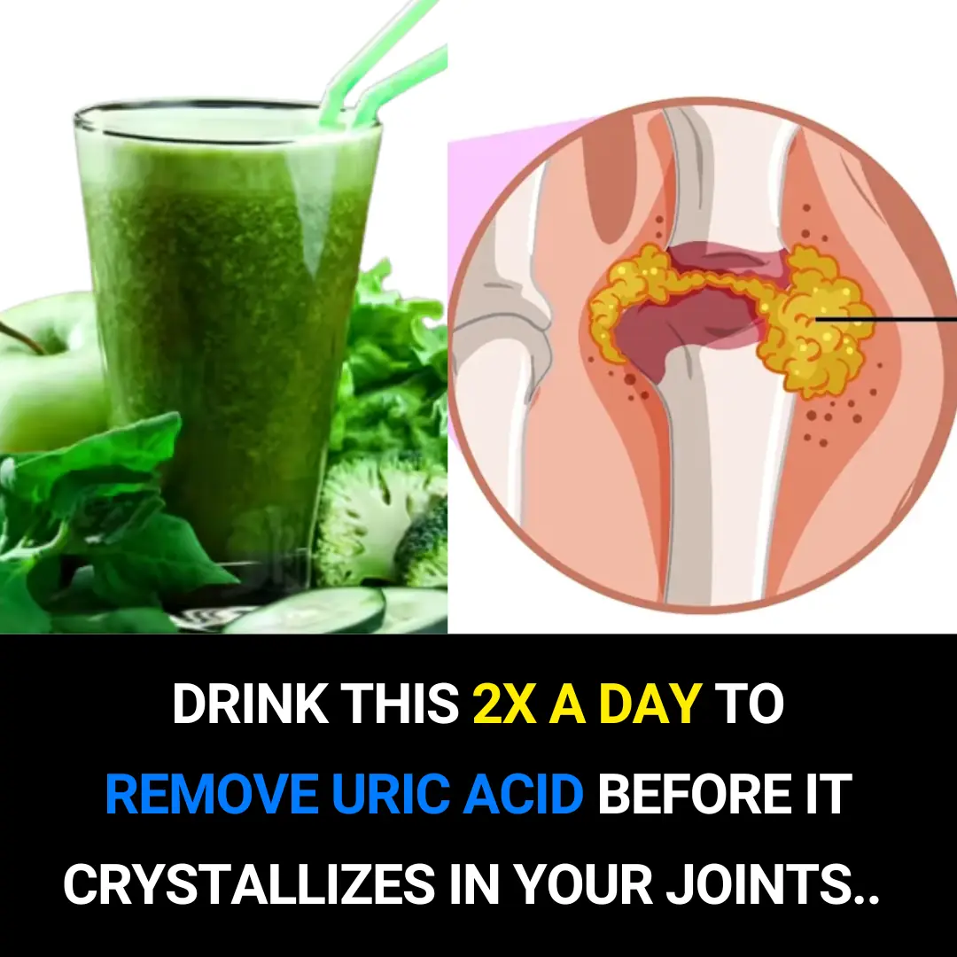 Drink This Twice a Day to Help Remove Uric Acid Before It Crystallizes and Causes Joint Pain