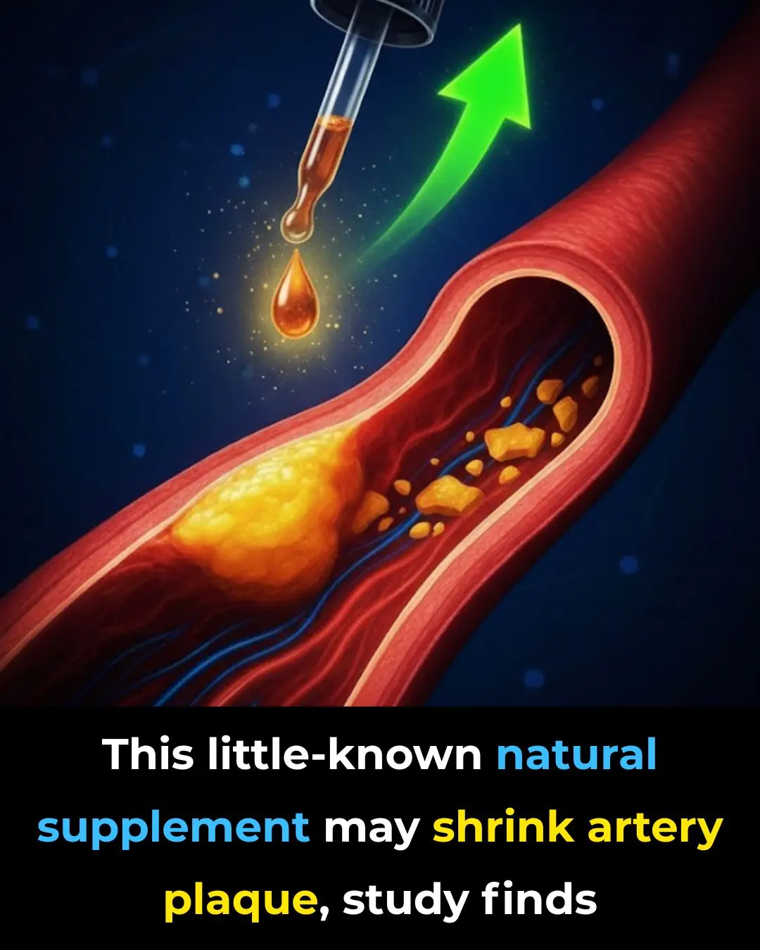 This little-known natural supplement may shrink artery plaque, study finds