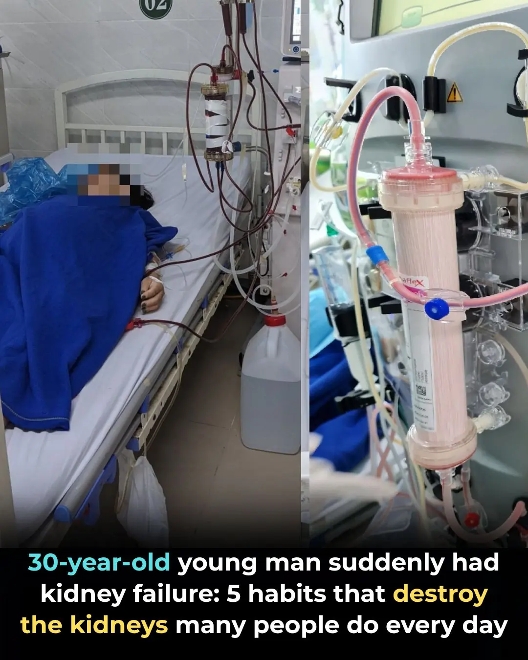 A 30-Year-Old Man Suddenly Developed Kidney Failure: 5 Daily Habits Destroying Your Kidneys Without You Realizing