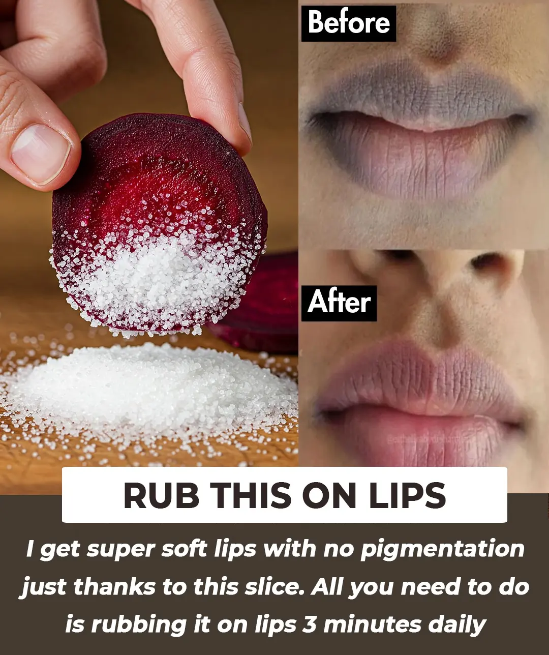 Super Effective DIYs to Achieve Soft, Pink, and Perfect Lips