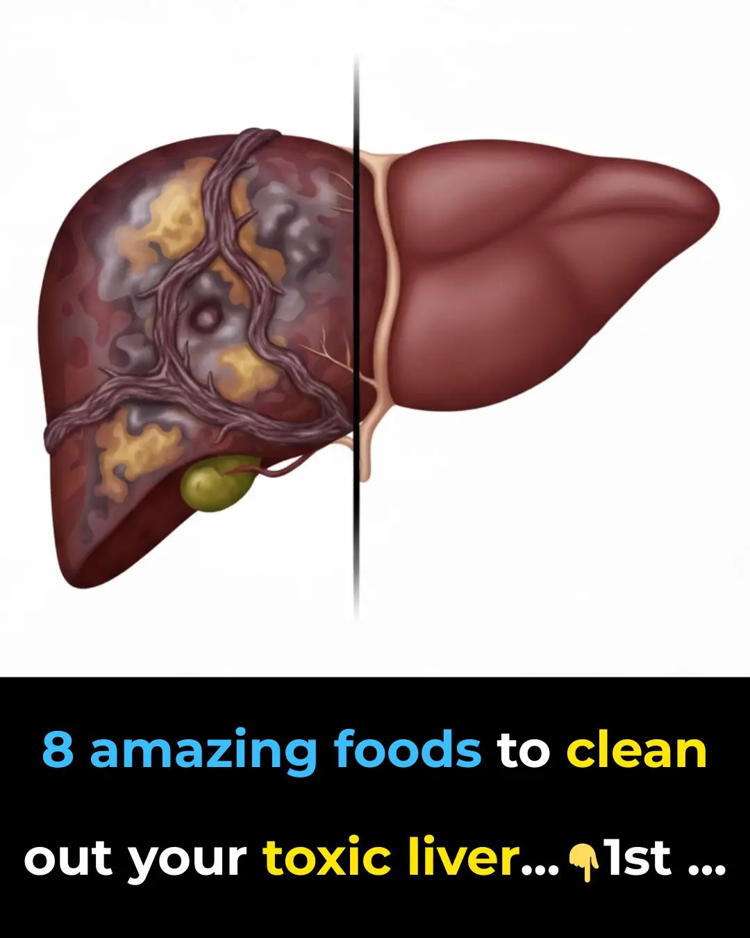8 Amazing Foods To Clean Out Your Toxic Liver