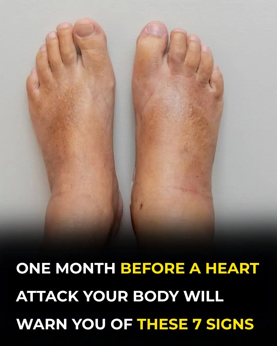 One Month Before A Heart Attack, Your Body Will Warn You Of These 7 Signs