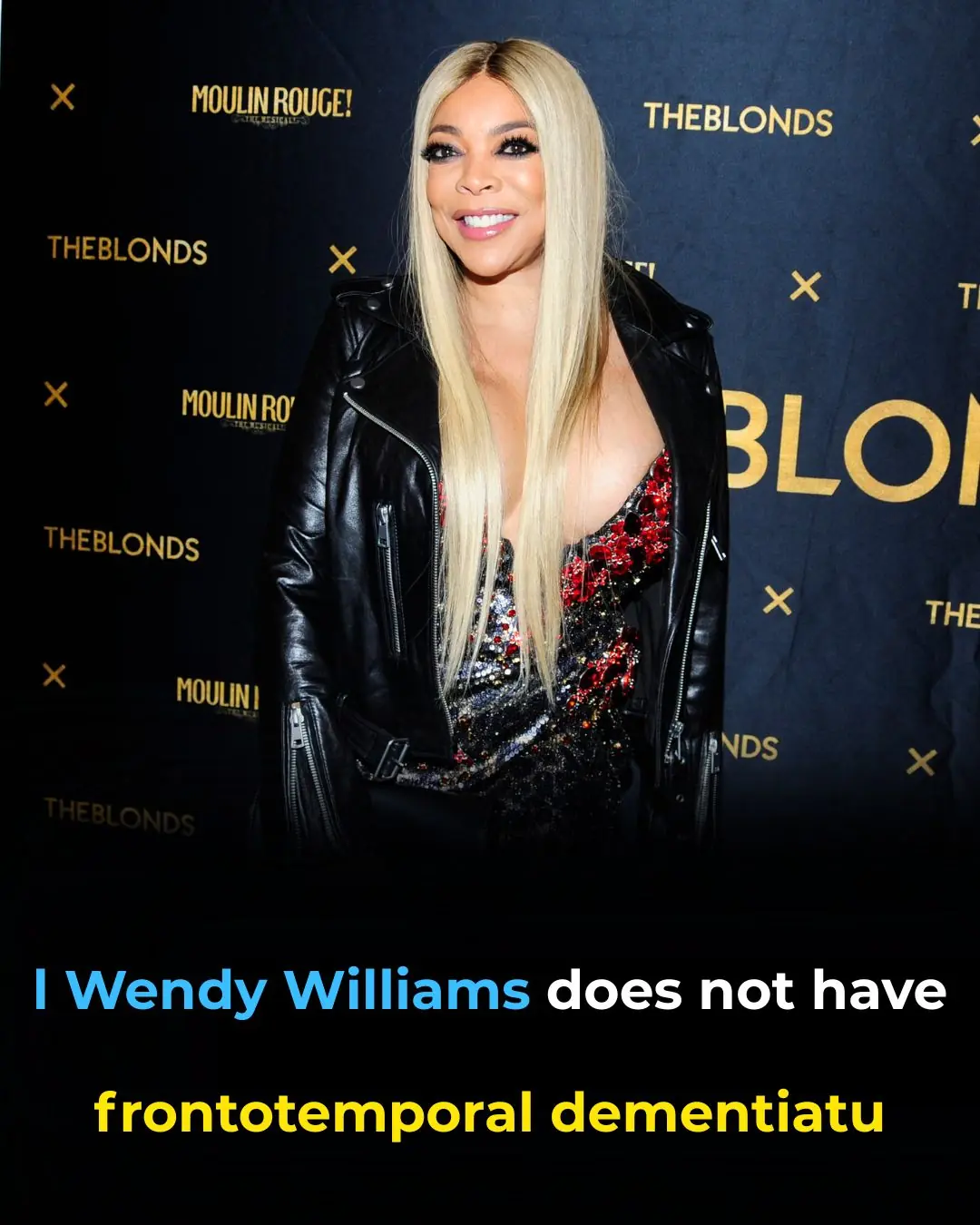 My Neurologist Says, No Frontotemporal Dementia!!!