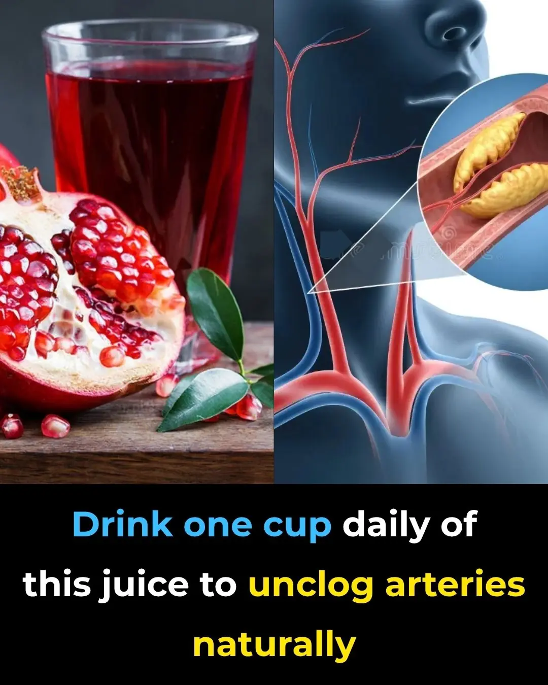Drink one cup daily of this juice to UNCLOG arteries?