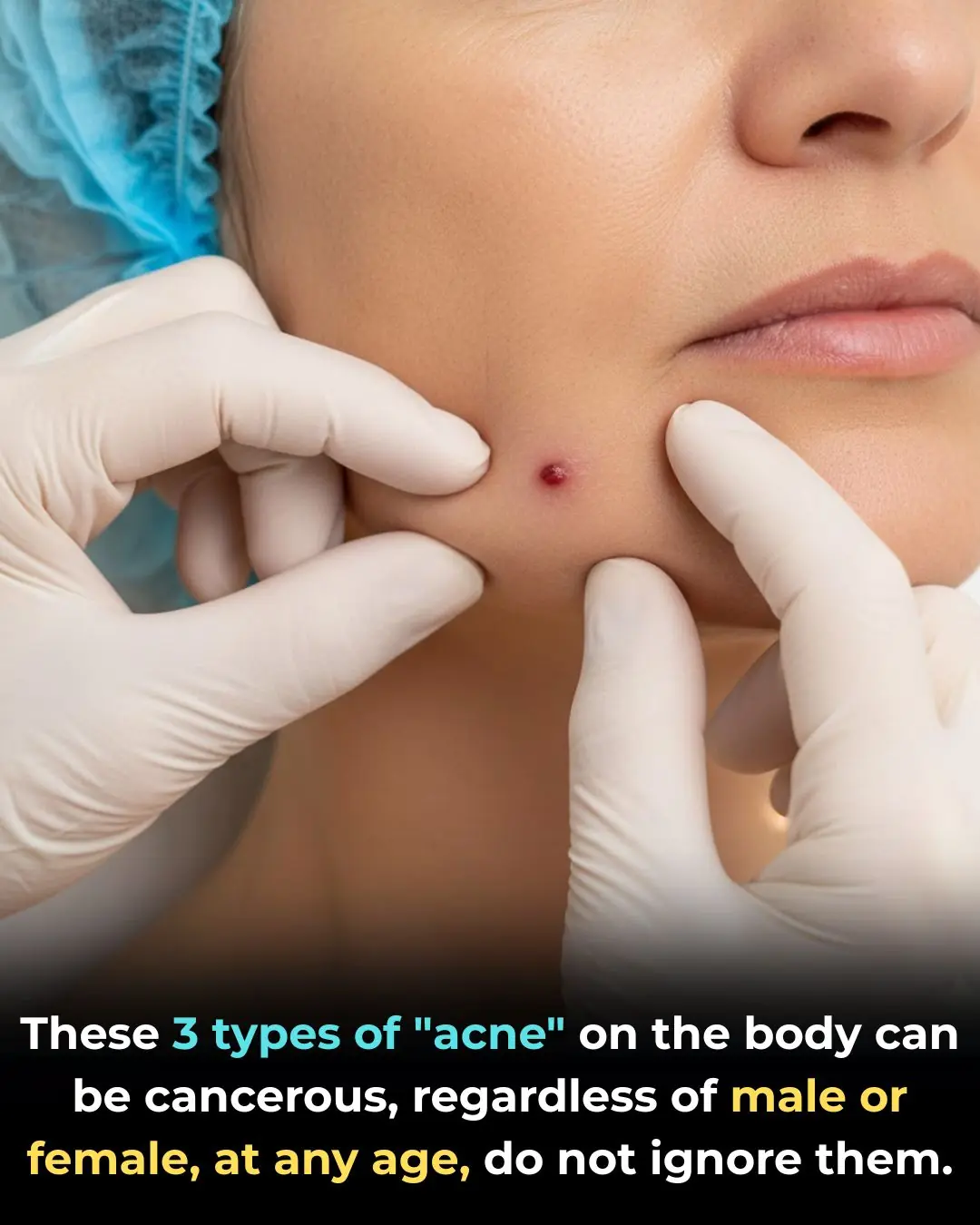 Three Types of “Lumps” on the Body That May Indicate Cancer — A Warning for Both Men and Women of All Ages