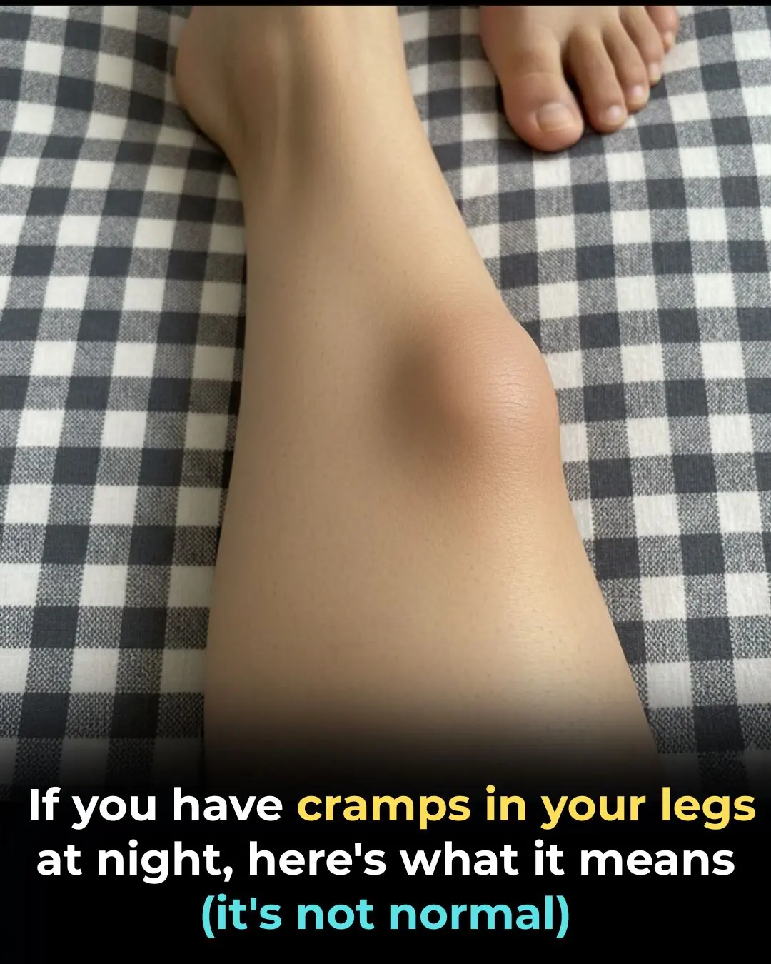 When Nighttime Leg Cramps Become a Concern