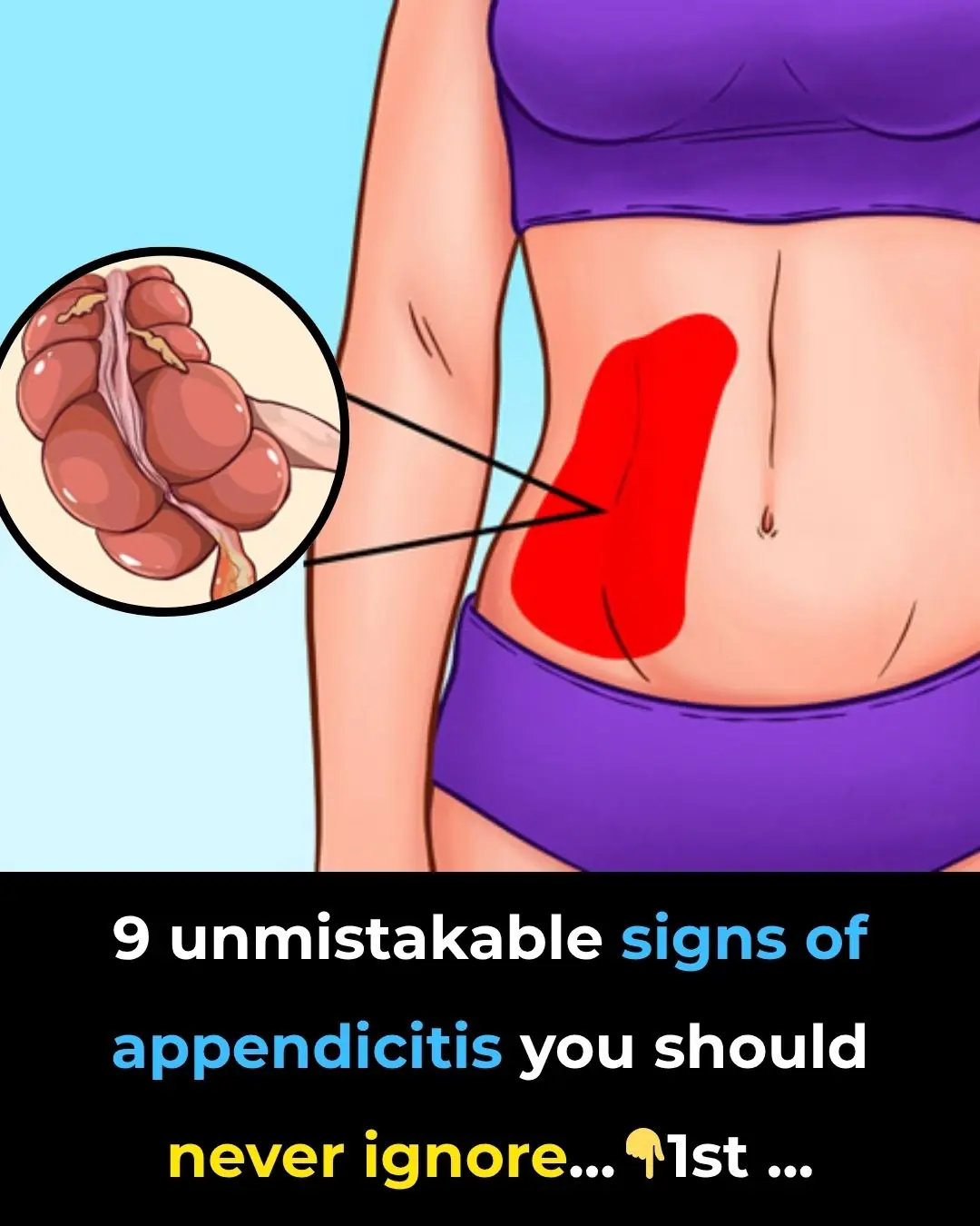 9 Unmistakable Signs Of Appendicitis You Should Never Ignore