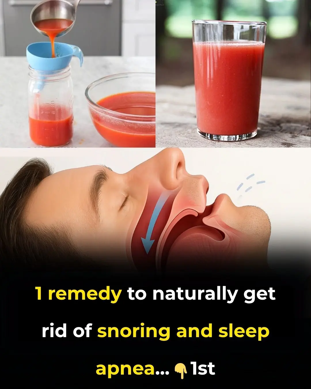 1 Remedy to Naturally Get Rid of Snoring and Sleep Apnea