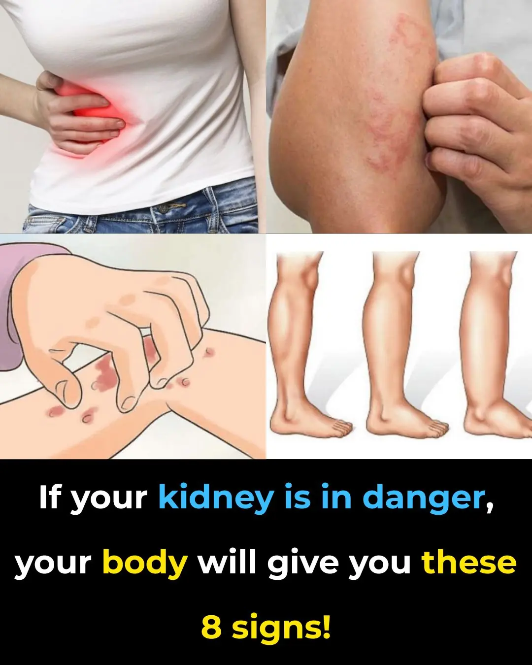 🩺 If Your Kidneys Are in Danger, Your Body Will Warn You With These 8 Signs