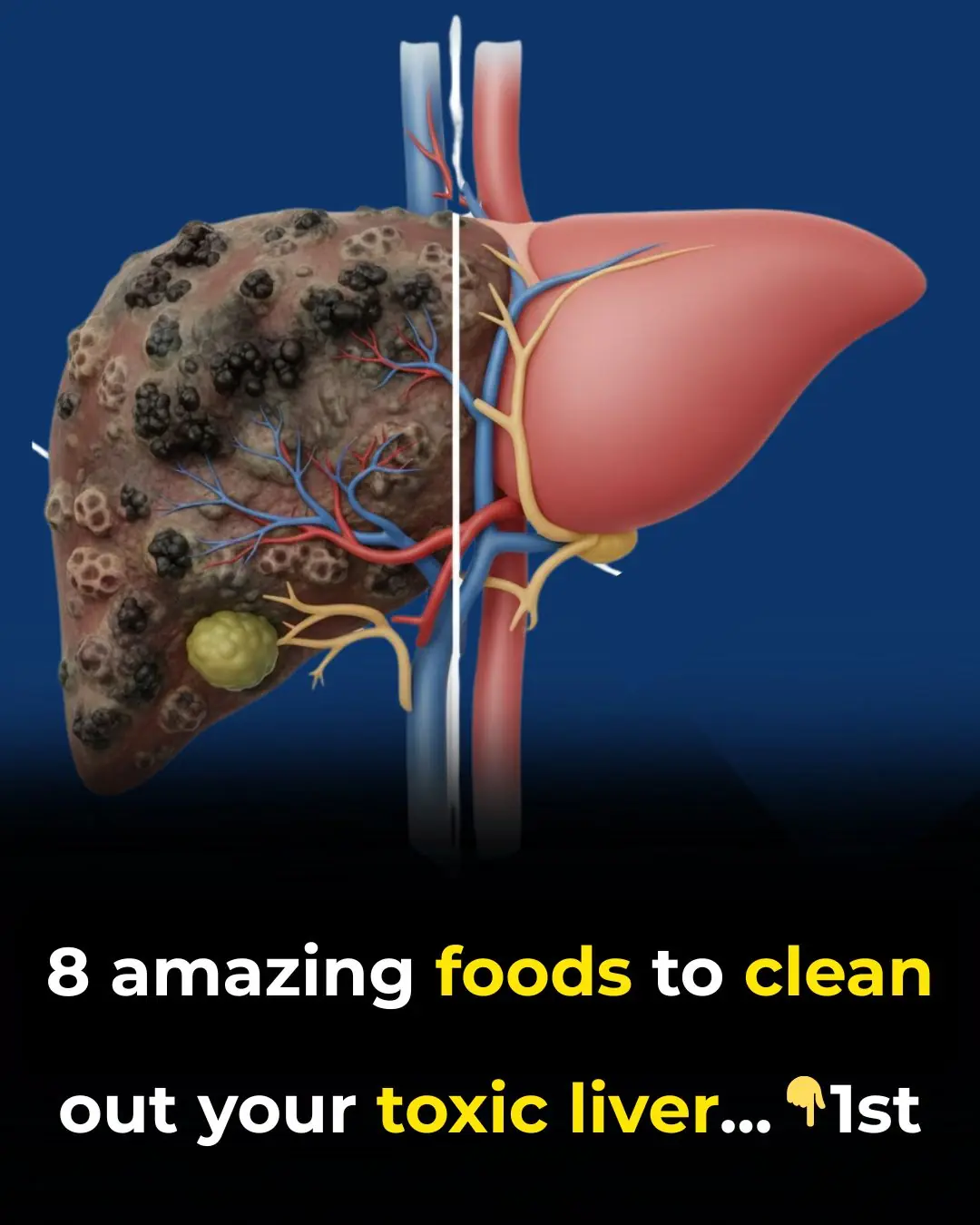 8 Amazing Foods To Clean Out Your Toxic Liver