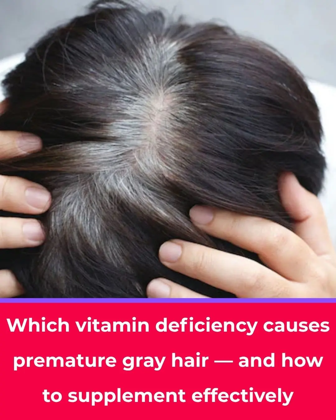 Which Vitamin Deficiency Causes Premature Gray Hair? How to Prevent Early Graying Effectively