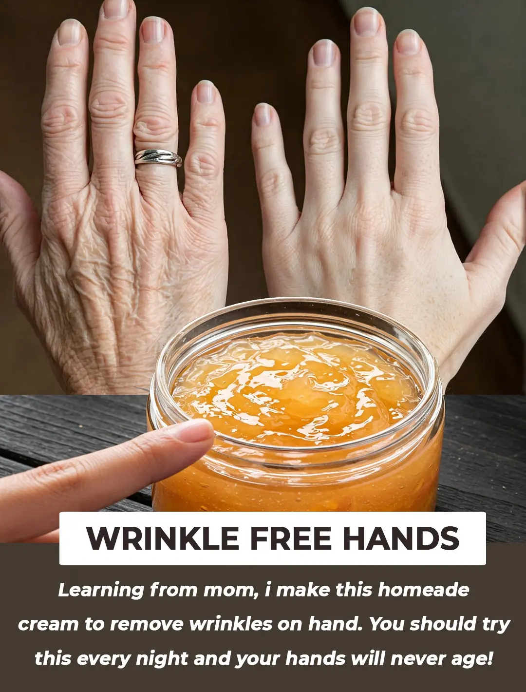 How to Remove Wrinkles from Hands – Wrinkle-Free Hands – Home Remedies