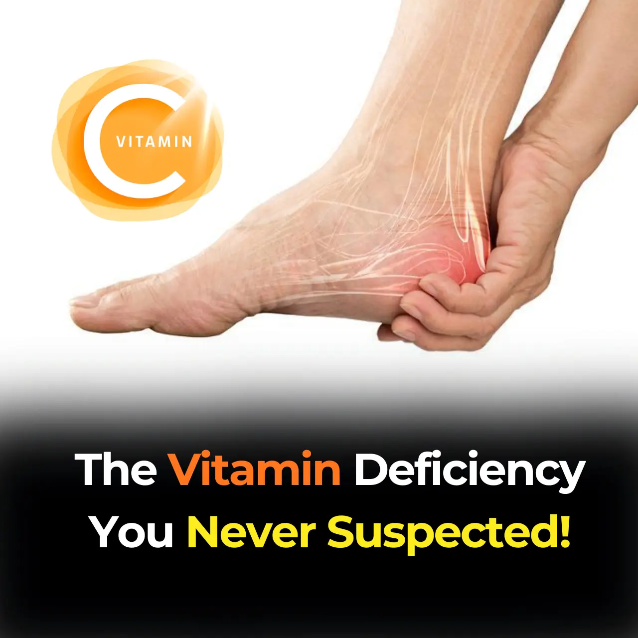 Nerve Pain Relief? The Vitamin Deficiency You Never Suspected!