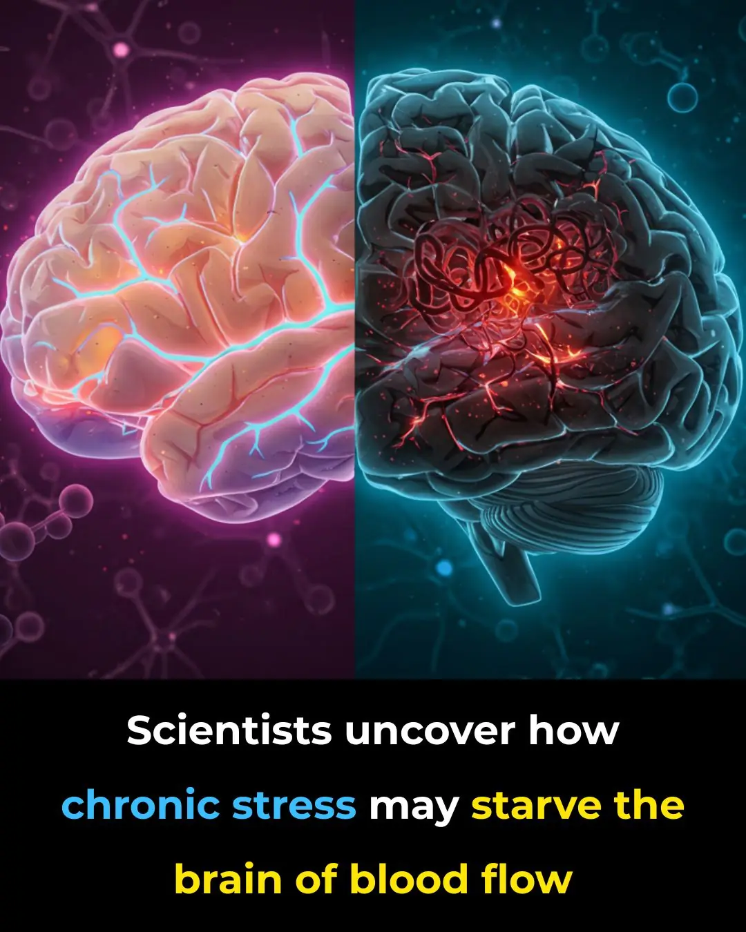 Scientists uncover how chronic stress may starve the brain of blood flow