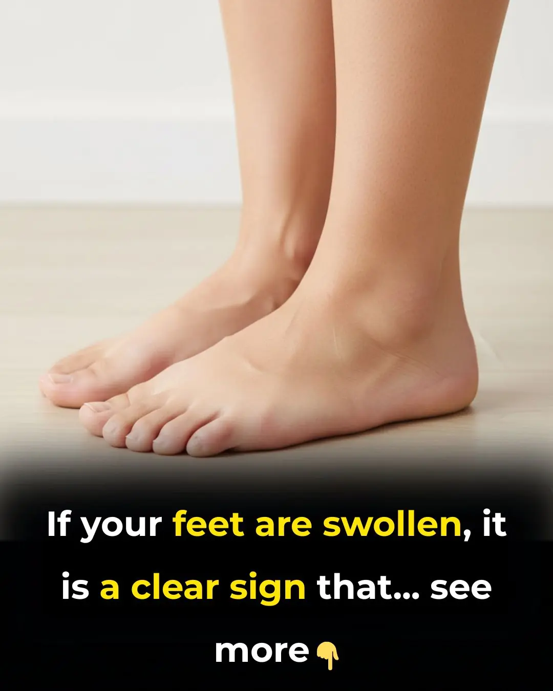 🦵 Swollen Legs and Feet: Causes, Symptoms & Natural Relief Methods