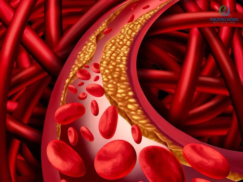 Powerful Foods That Help Prevent Clogged Arteries And Keep Your Heart Feeling 20 Again