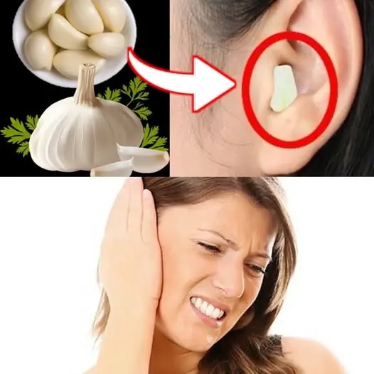 Garlic for Ear Health: Natural Relief and Protection