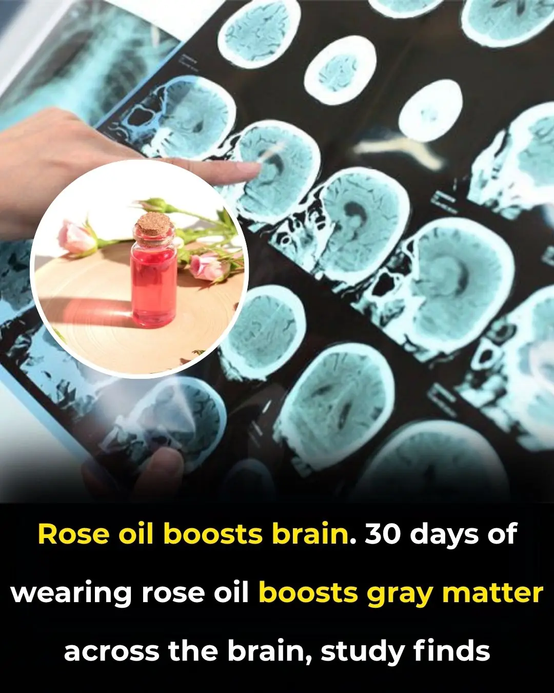 Rose Essential Oil May Boost Brain Structure: New Study Reveals Increased Gray Matter Volume