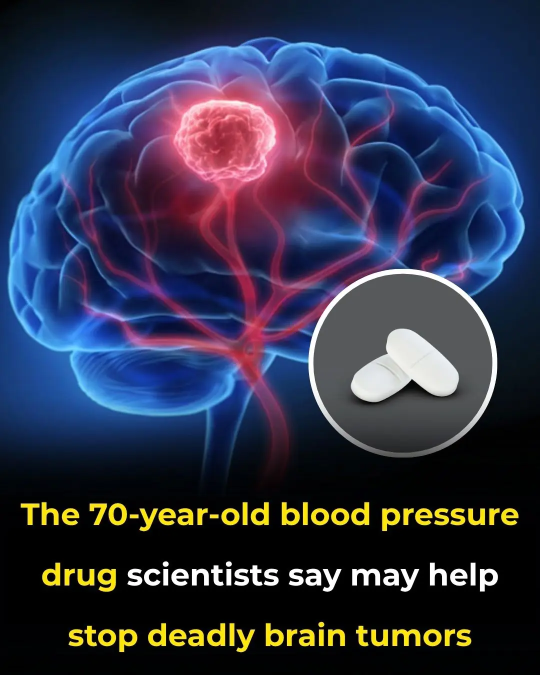 The 70-year-old blood pressure drug scientists say may help stop deadly brain tumors