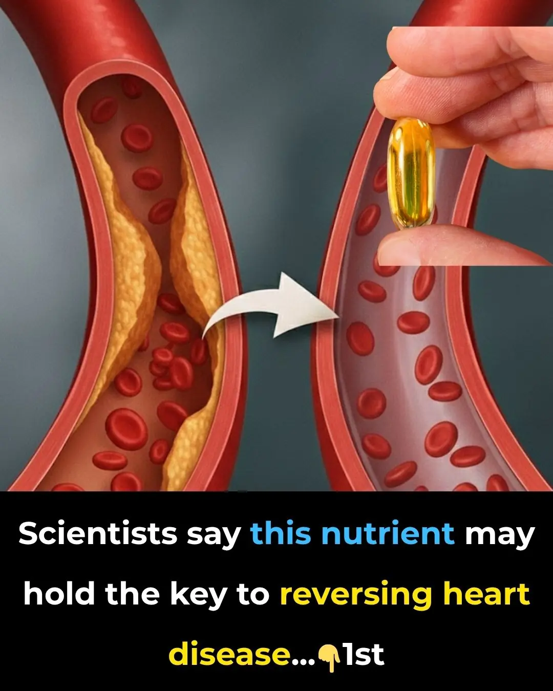 Scientists say this nutrient may hold the key to reversing heart disease