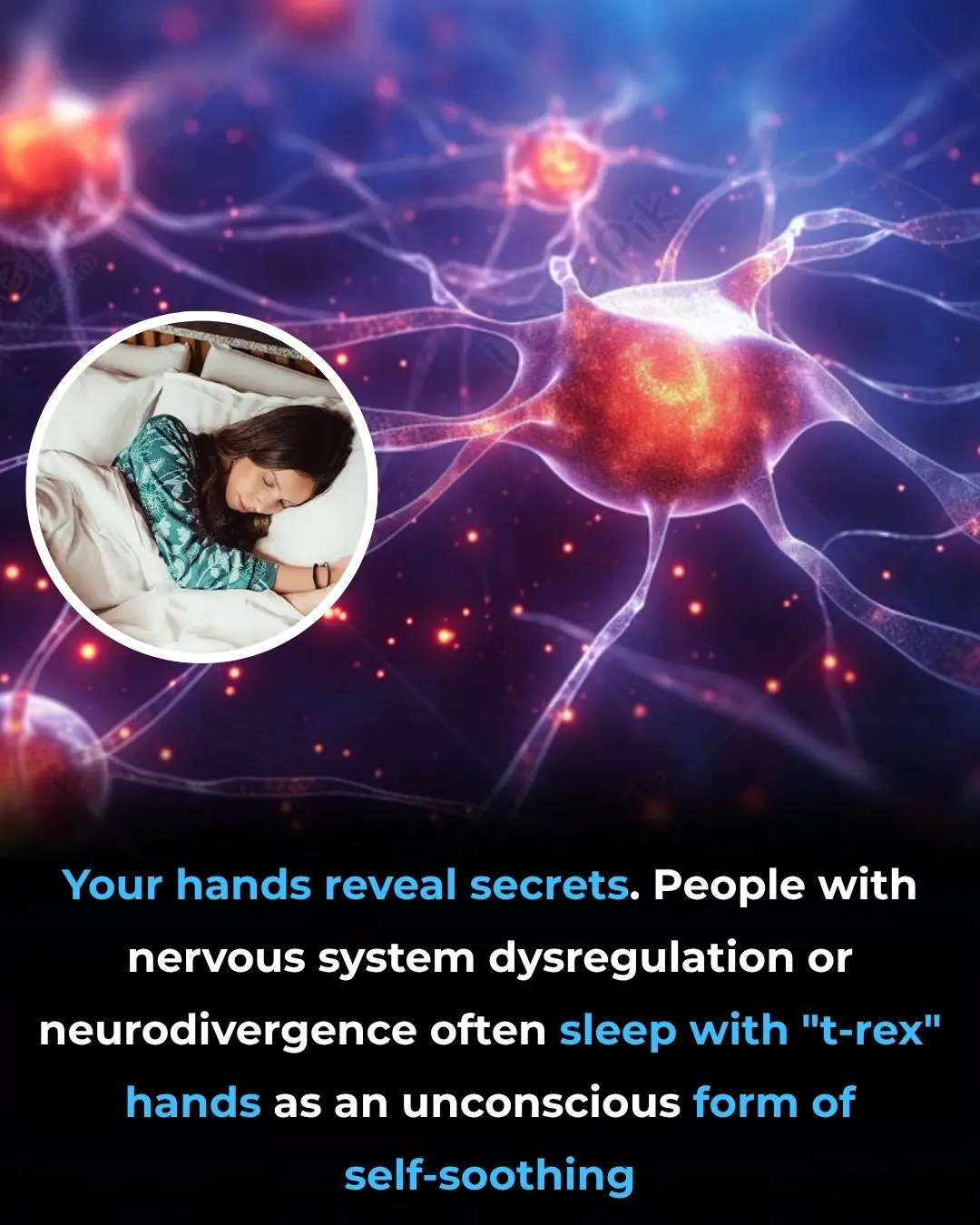 Why We Sleep With ‘T-Rex Arms’: A Self-Soothing Posture Linked to Stress and Neurodivergence