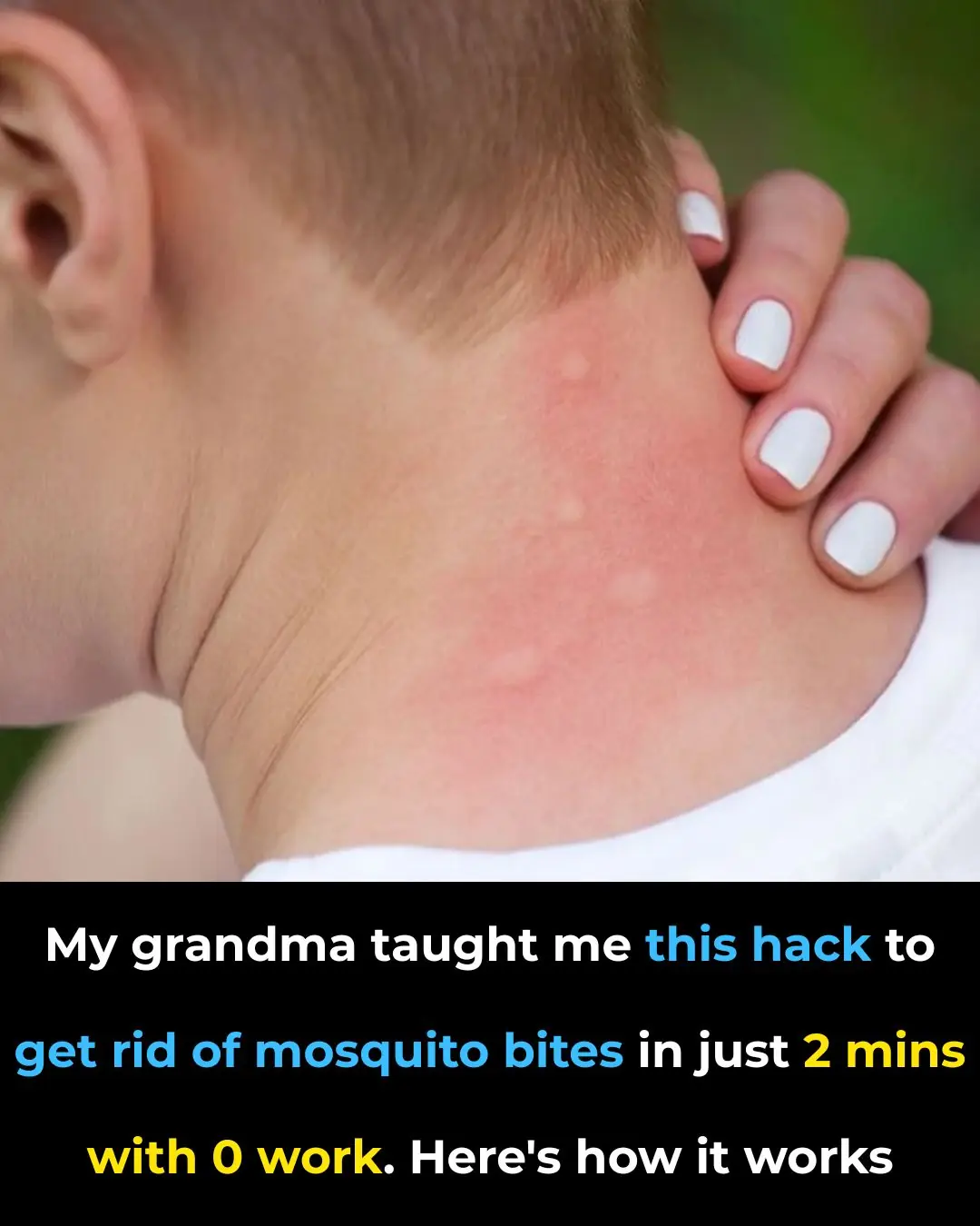 The Hot Spoon Hack for Mosquito Bites