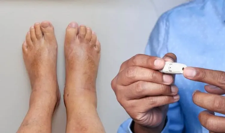 Your Feet Are A ‘Blood Sugar Meter’ – Beware Of Diabetes If You Frequently Experience These 12 Symptoms