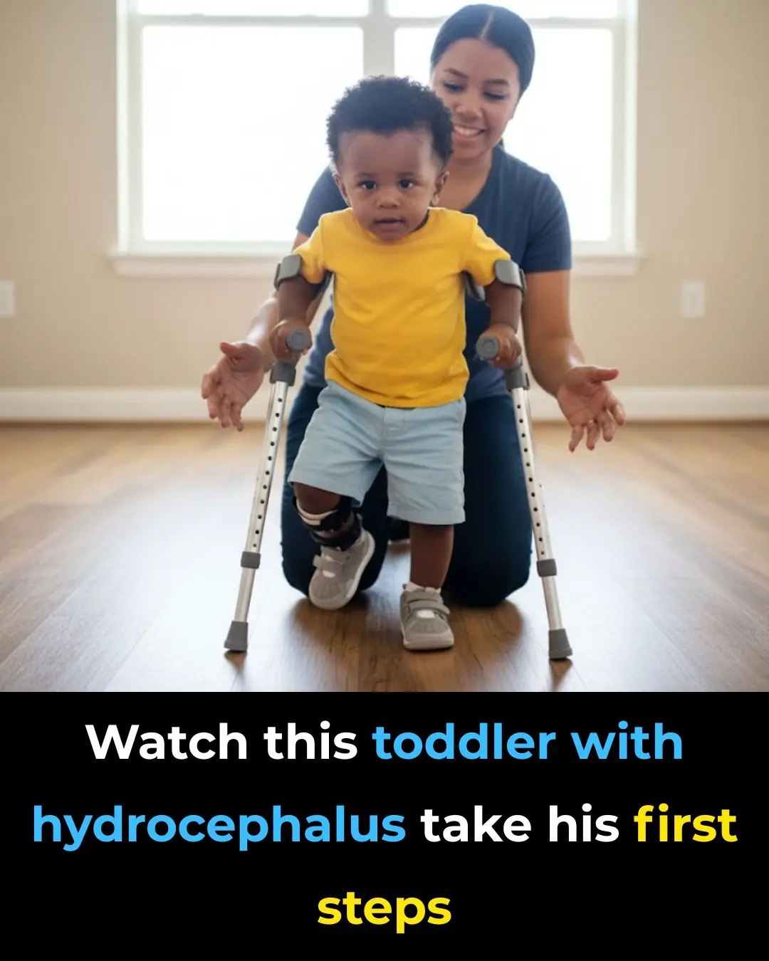 Priceless: Watch This Toddler With Hydrocephalus Take His First Steps