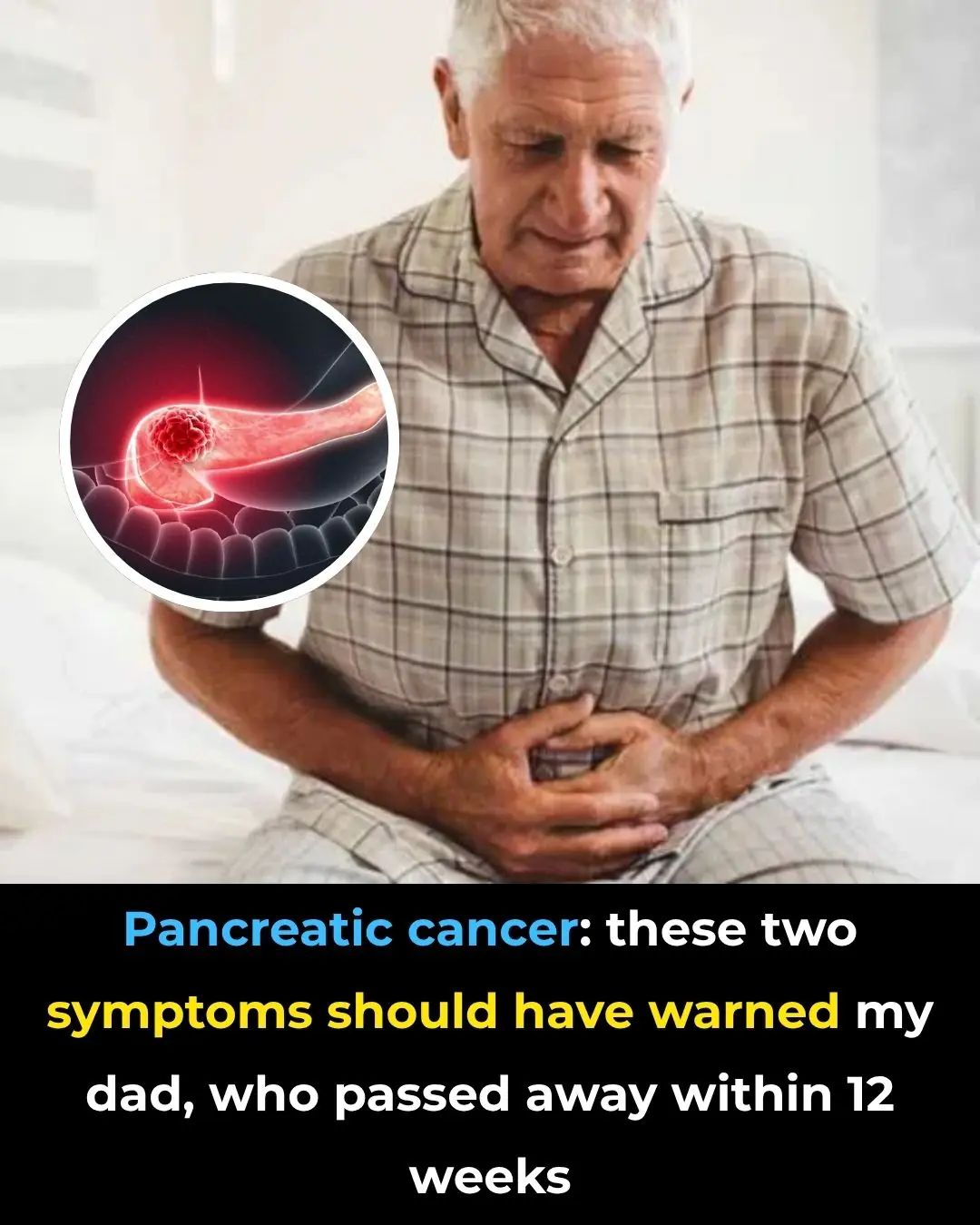Signs of pancreatic cancer you should never ignore