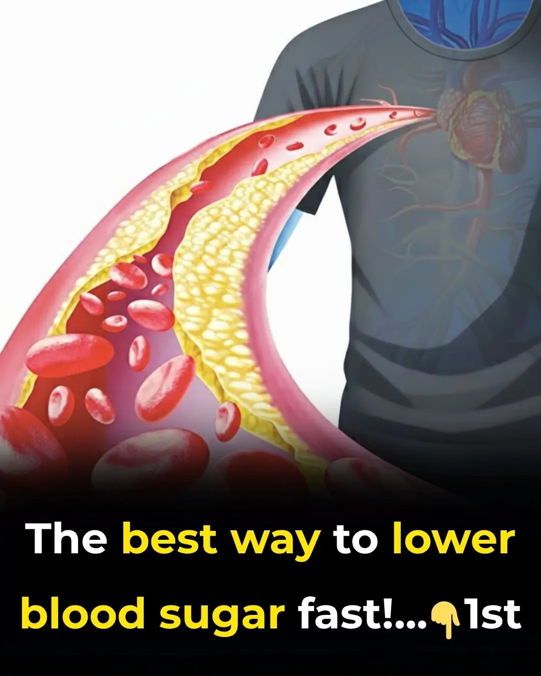 The best way to lower blood sugar fast!