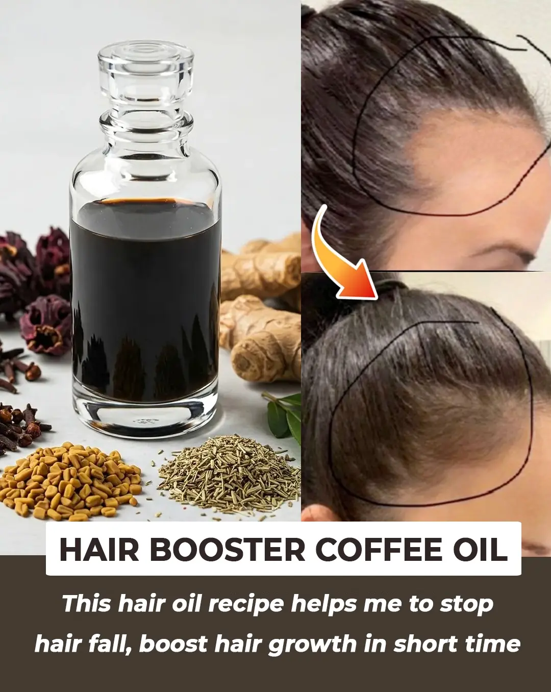 This Hair Oil Recipe Will Stop Hair Fall in Just One Use!